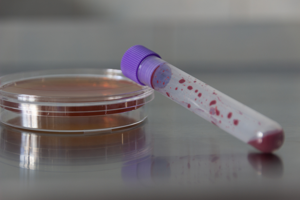 Blood sample and petri dish on a chemical-resistant stainless steel table 